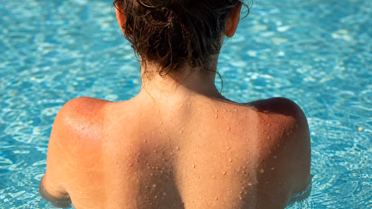 Épaules et dos d'un baigneur émergeant de l'eau d'une piscine en plein soleil, peau marquée par l'exposition